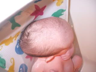 sutures overlapping head sons photobucket babycenter