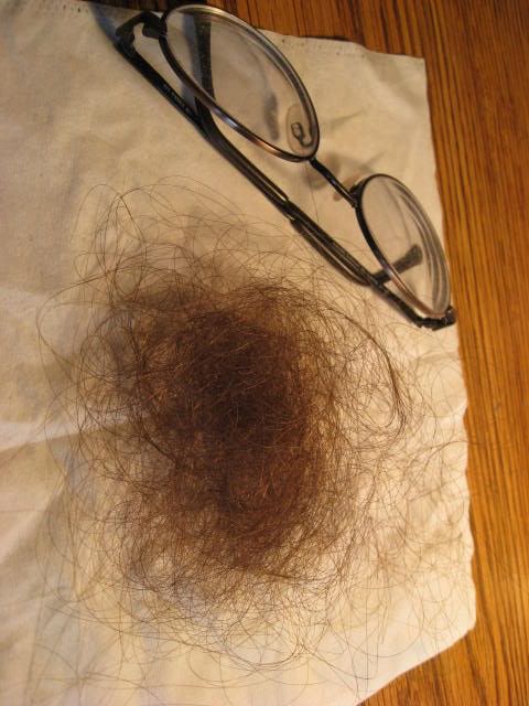 hair photo:hair loss from stress 